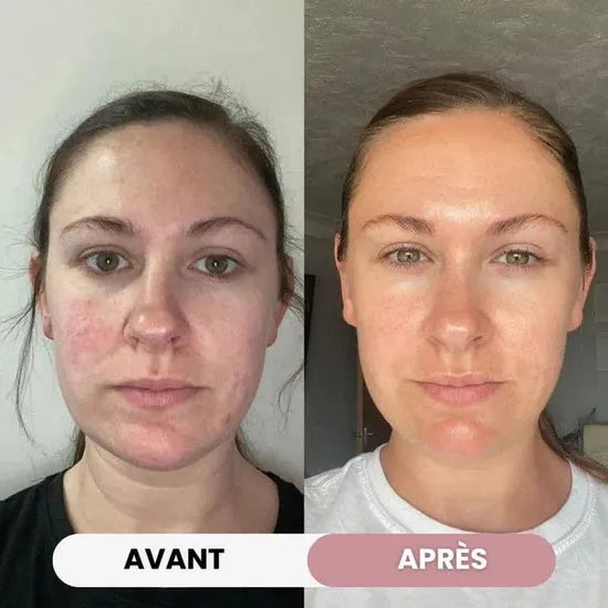 Escultor facial 7-en-1
