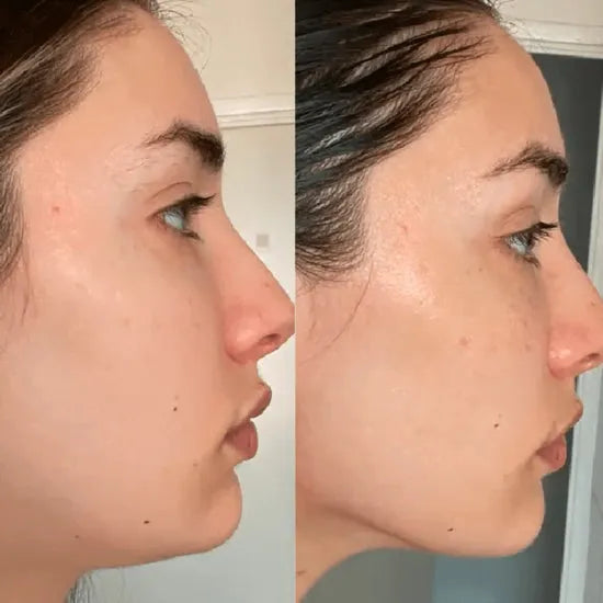Escultor facial 7-en-1