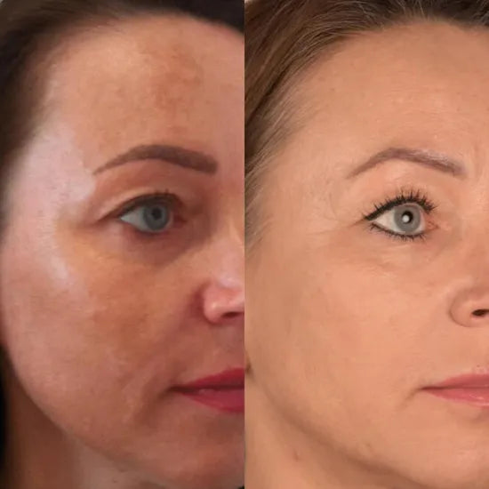 Escultor facial 7-en-1