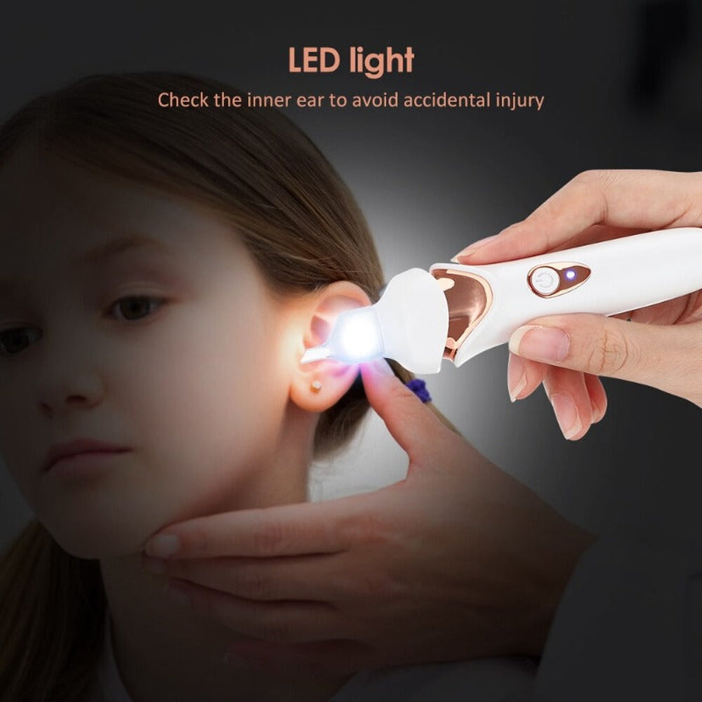 Aspirador de cerumen indoloro
